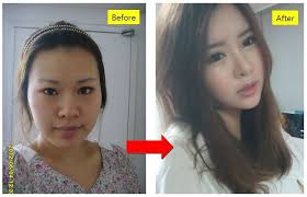Skin Care Advice That Will Help At Any Age Korean Plastic Surgery Plastic Surgery In Korea Cosmetic Surgery In Korea Before And After Beauty Eye Surgery D Facial Contouring Korean Plastic