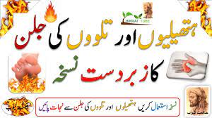 Hath paon ki jalan ka ilaj/remedy for burning feet and hands/hath paon jalan ka ilaj/tips/totke/hath paon ki jalan or erion k. Hath Paon Ki Jalan Ka Ilaj Remedy For Burning Feet And Hands Hath Paon Jalan Ka Ilaj Tips Totke Youtube