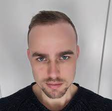 Een haartransplantatie is simpelweg het verplaatsen van haarzakjes, maar hoe dit gebeurt kan erg verschillen. Esteworld Voelt Als Thuiskomen