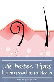 eingewachsene haare im intimbereich loswerden we go wild holidayhair verabschiede dich von eingewachsenen haaren im intimbereich mit diese tips rujlar blog