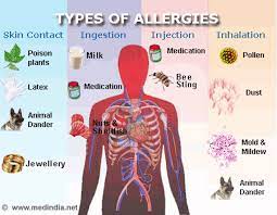 Is It An Allergy Allergy Symptoms Allergy Types Allergies