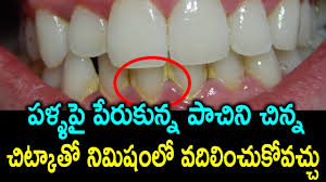 Aug 17, 2017 · to brush your teeth: How To Remove Tartar And Plaque From Teeth At Home Naturally Health Tips In Telugu Youtube