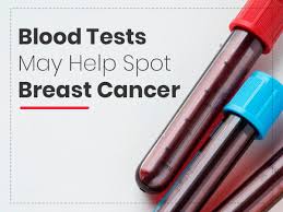The test detected cancer with 69 to 98 percent accuracy, the study found. Blood Tests May Help Detect Breast Cancer Says Recent Study Boldsky Com