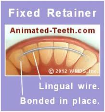 And how often should you wash to keep the grease at bay and your hair as healthy as possible? Cleaning Orthodontic Retainers How To How Often