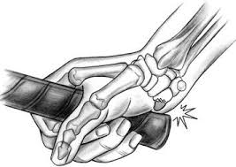 Image result for Hamate Bone