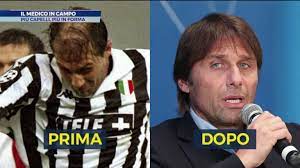 Sottoporsi ad un trapianto di capelli è un passo importante, per questo vogliamo che tu possa compierlo in piena serenità. Trapianto Di Capelli E Sport Il Medico In Campo Su Sport Mediaset