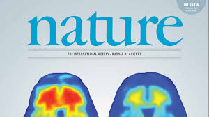 It was developed by biogen inc., which licensed the drug candidate from neurimmune, its discoverer. Rhode Island S Role In Promising New Alzheimer S Results Brown University