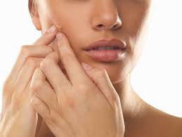 Living with severe acne can be tough on your psyche. L Acne D Adulte Les Causes Et Les Solutions Pour S En Sortir Blogue Dermapure
