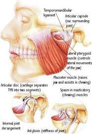 Treatment is focused on behavioral modification as opposed to joint repair. 8 Tmj Massage Ideas Tmj Tmj Relief Tmj Massage