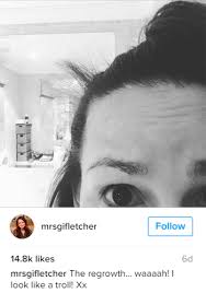 How to prevent hair loss after pregnancy. Giovanna Fletcher Shows Hair Growth After Postpartum Alopecia