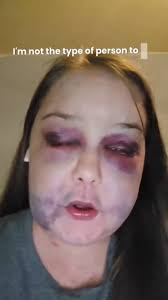 Nah, Call The Police baby 😩