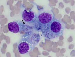 And i've gather the 5 best tips to help. Canine Thyroid Carcinoma In 4 Year Old American Bulldog Clinical Pathology Perspective