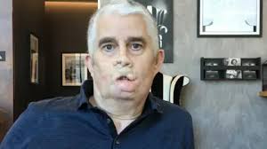 I lost my arms and legs