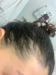 Although this seems harmless, excess oil can clog pores on your scalp which can prevent your hair follicles from growing normally! 25yrs Is This Norma My Hair Also Gets Very Greasy After Only About 2 Days Now When Before It Could Withstand 4 I M Very Concerned It Feels Like My Hair Is Constantly