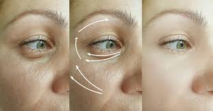 Kulit kusam adalah tanda proses penuaan berlaku. Muka Berkedut Dan Kulit Kusam Kerana Tengok Wayang Hello Doktor