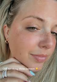 Embracing My Freckles: A Journey of Self-Love