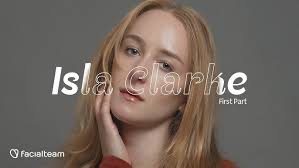 Michelle, Australia — FFS Surgery Stories