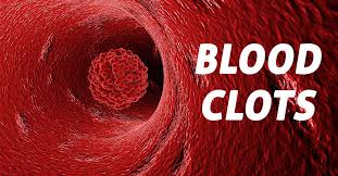 In other areas, you may feel pain due to a loss of oxygen to. Signs And Symptoms Of Blood Clots Elite Medical Center