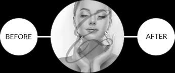 Radiance Plastic Surgery - Dr. Michael Laliberte | Official Page