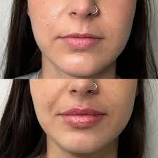 Brooke Carrero RN, BSN