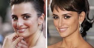Penelope Cruz Celebrity Penelope Cruz Before And After Plastic Surgery Nose Job Rhinoplast Celebrity Plastic Surgery Plastic Surgery Plastic Surgery Photos
