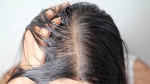 Image result for Neurodermatitis