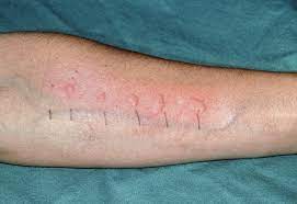 Check spelling or type a new query. Gezielte Provokation