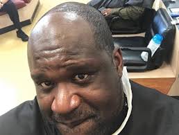 Almost half of the worldwide population suffers from abnormal hair loss at some point in life. Battle Of Receding Nba Hairlines Continues With Shaq Headlining Thescore Com