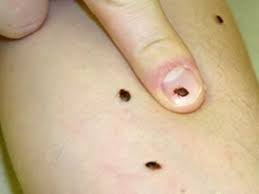 pin on health