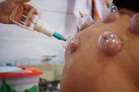 Kalender Marketing Terapi Bekam