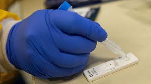 Tiene mutaciones que afectan a una parte del virus que probablemente sea importante. Que Tan Preocupante Es La Nueva Cepa Del Coronavirus De Reino Unido