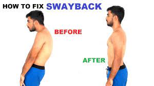 These are not the same thing and the two should be. How To Fix Swayback Posture Correction In Hindi Youtube