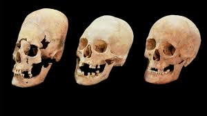 Strange Elongated Skulls Reveal Medieval Bulgarian Brides Were Traded For Politics Science Aaas These elongated skulls are much, much larger than normal human skulls would be. strange elongated skulls reveal