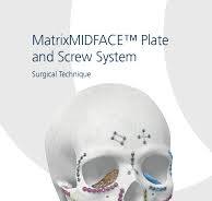 MatrixMIDFACE™ Plate | PDF | Screw | Surgery