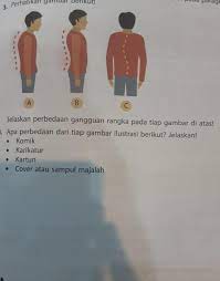 Maybe you would like to learn more about one of these? Jelaskan Perbedaan Gangguan Rangka Pada Tiap Gambar Di Atas Brainly Co Id