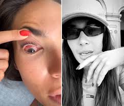 Qué le pasa a Ana Moya? La 'influencer' muestra los problemas de visión y  los fuertes dolores que está sufriendo