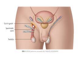 Symptoms of advanced prostate cancer symptoms of advanced prostate cancer include: Testicular Cancer Patient Information