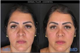 TOP 10 BEST Nutrition Counseling in Pomfret, CT