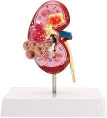 Amazon.co.jp: ボディモデル1Pc腎臓解剖学モデル2-側面の病気の解剖学メディカルグロメルルス腎臓ネフロン腎解剖学モデル :  産業・研究開発用品