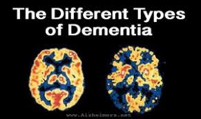 Click on the different category headings to find out more. What Are The Different Types Of Dementia