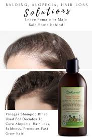 Balding Alopecia Hair Loss Solutions Hair Loss Solutions Vinegar Nutritive Rinse Cleanser Hair Loss