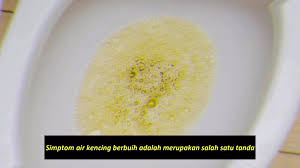 Melalui urine atau air kencing pun kita boleh alert tentang kesihatan tubuh kita. Viral Terindah Kencing Berbuih Merupakan Tanda Facebook