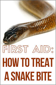 They appear in either brownish or grayish. Pin On Snake Bites