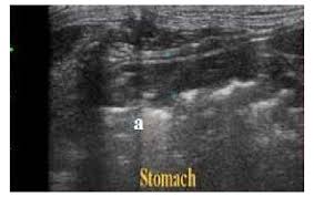 At two years, the pet will have an equivalent age of twenty four. Ultrasound Cross Scan In A 7 Years Old Cat Showing A Thickened Wall Of Download Scientific Diagram