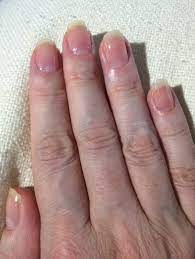 Is it possible to grow long and strong nails? After A Lifetime Of Biting My Fingernails Will They Ever Really Return To Normal Quora