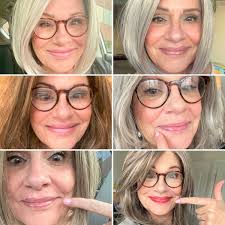 Filler Up! My Face–Not My Gas Tank! or..My Experience With Fillers!