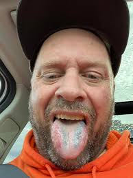 Riding a 1996 Honda 605 with seizures