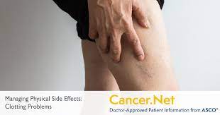Bleeding Problems Cancer Net