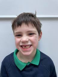 Hi my son is 12 he's autism and afrid, he was diagnosed with a post natural  drip ( the tube you have in your nose to your throat is too narrow) so