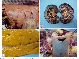 Image result for Copper Poisoning